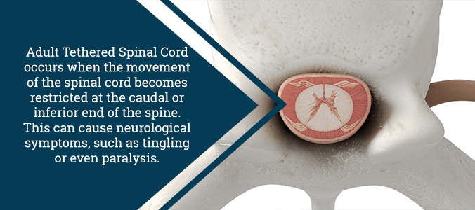 spinal cord graphic
