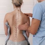 severe scoliosis before correction